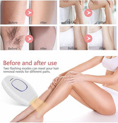 Home Use IPL Beauty Device – Permanent Hair Removal for Whole Body, Painless Laser Hair Removal Device for Women and Men