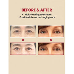 KSECRET SEOUL 1988 Eye Cream – Retinal Liposome 4% + Fermented Bean, Anti-Aging Wrinkle Care, Improves Elasticity & Pigmentation, 30ml / 1.01 fl.oz