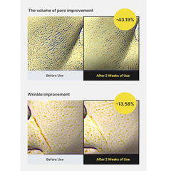 THE VITA-A Retinol Shot Tightening Serum. Potent anti-aging treatment for wrinkles, firmness & skin renewal. 30ml.