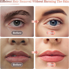 Flawbless Facial Hair Remover for Women – Elegance Meets Efficiency